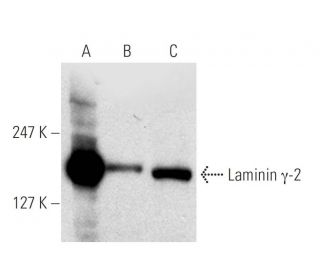 western blotting image from recommended Laminin &gamma;-2 (E-6) monoclonal antibody replacement. Image 7541
