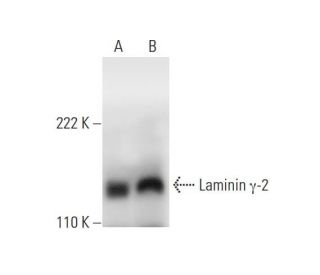 Laminin &gamma;-2 Antibody (G-7) - Western Blotting - Image 293044 