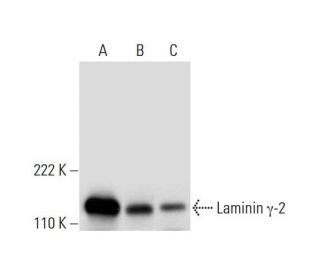 Laminin &gamma;-2 Antibody (H-8) - Western Blotting - Image 295997 