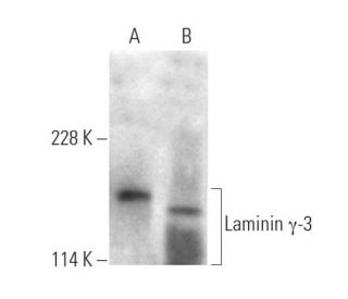 Laminin &gamma;-3 Antibody (2#) - Western Blotting - Image 374573