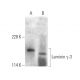 Laminin γ-3 Antibody (2#) - Western Blotting - Image 374573