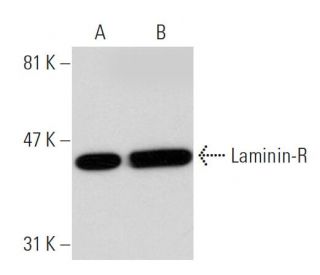 Laminin-R Antibody (16) - Western Blotting - Image 39096 