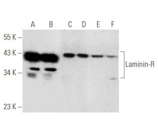 western blotting image from recommended Laminin-R (H-2) monoclonal antibody replacement. Image 356628