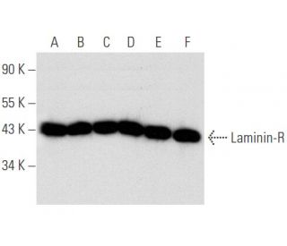 Laminin-R Antibody (A-7) - Western Blotting - Image 356624Each CRISPR/Cas9 Knockout (KO) Plasmid product consists of a pool of 3 plasmids designed to ensure identification and cleavage of a specific gene for maximum knockout efficiency. Each plasmid encodes a unique 20 nt sequence derived from the GeCKO (v2) library.