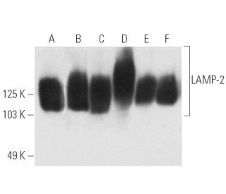 western blotting image from recommended LAMP-2 (H4B4) monoclonal antibody replacement. Image 4908