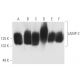 western blotting image from recommended LAMP-2 (H4B4) monoclonal antibody replacement. Image 4908