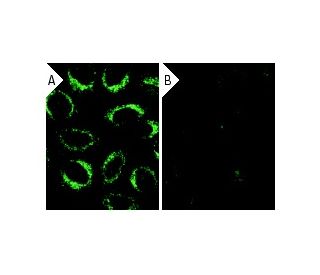 LAMP-2 siRNA (h): sc-29390. Immunofluorescence staining of methanol-fixed, control HeLa (A) and LAMP-2 siRNA silenced HeLa 