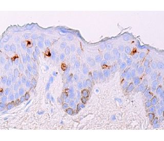 immunohistochemistry image from recommended Langerin (H-4) monoclonal antibody replacement. Image 378079