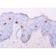 Cet anticorps polyclonal n'est plus commercialisé. Voir l'anticorps monoclonal <a href="langerin-antibody-h-4">Langerin (H-4)</a> que nous recommandons (données d'échantillonnage indiquées). immunohistochemistry image from recommended Langerin (H-4) monoclonal antibody replacement. Image 378079
