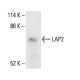 LAP2 Antibody (3A3) - Western Blotting - Image 411212