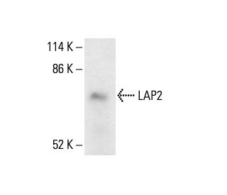 LAP2 Antibody (3A3) - Western Blotting - Image 411212SAM Transcription Activation: SAM system utilizing dCas9-VP64, MS2-P65-HSF1, and sgRNA for precise gene transcription activation.
