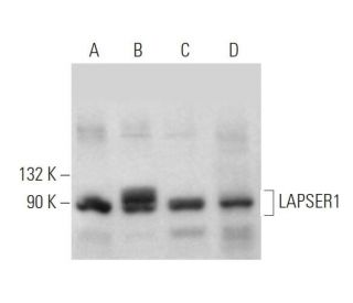 LAPSER1 Antibody (B-5) - Western Blotting - Image 372505 