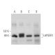 LAPSER1 Antibody (B-5) - Western Blotting - Image 372505 