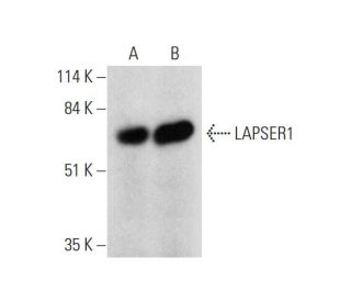 LAPSER1 Antibody (D-7) - Western Blotting - Image 331168 
