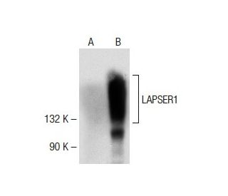 LAPSER1 Antibody (F-11) - Western Blotting - Image 141560 