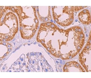 immunohistochemistry image from recommended LARG (H-3) monoclonal antibody replacement. Image 374082