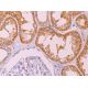 immunohistochemistry image from recommended LARG (H-3) monoclonal antibody replacement. Image 374082