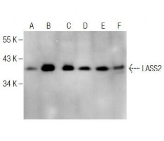 LASS2 Antibody (FT-7): sc-100553