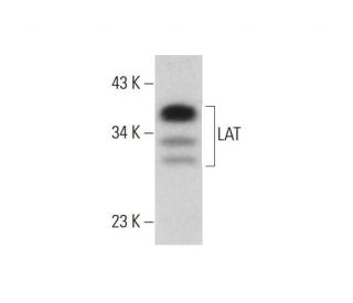 LAT Antibody (F-7) - Western Blotting - Image 317972