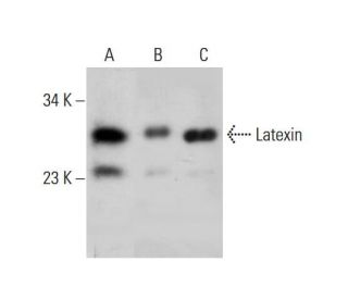 Latexin Antibody (199CT6.1.2) - Western Blotting - Image 384239