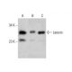 Latexin Antibody (199CT6.1.2) - Western Blotting - Image 384239