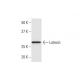 Latexin Antibody (8H5) - Western Blotting - Image 352203 