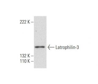 Latrophilin-3 Antibody (B-6) - Western Blotting - Image 296954Each CRISPR/Cas9 Knockout (KO) Plasmid product consists of a pool of 3 plasmids designed to ensure identification and cleavage of a specific gene for maximum knockout efficiency. Each plasmid encodes a unique 20 nt sequence derived from the GeCKO (v2) library.
