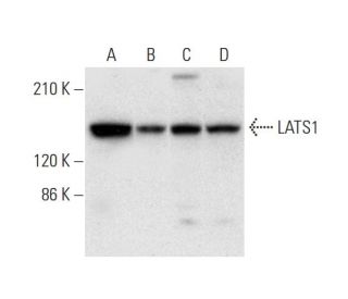 western blotting image from recommended LATS1 (G-12) monoclonal antibody replacement. Image 305786