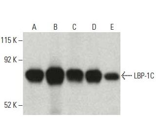 LBP-1C Antibody (14) - Western Blotting - Image 396646 
