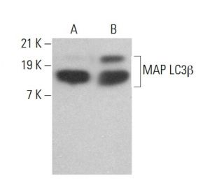 LC3B Antibody (G-9) - Western Blotting - Image 380240
