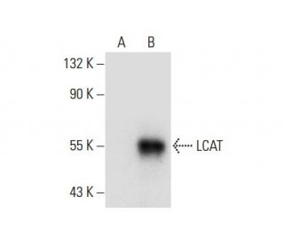 LCAT Antibody (B-4) - Western Blotting - Image 303917