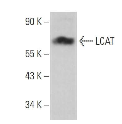 LCAT Antibody (D-3) | SCBT - Santa Cruz Biotechnology