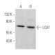 LCAT Antibody (D-3) - Western Blotting - Image 364680