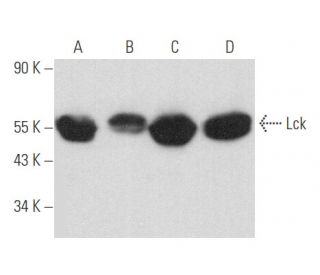 Lck Antibody (0.T.84) - Western Blotting - Image 357711 