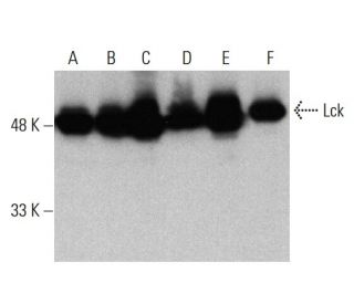 western blotting image from recommended Lck (3A5) monoclonal antibody replacement. Image 384026
