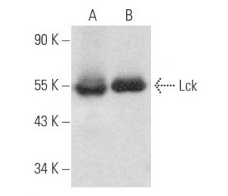 Lck Antibody (B-10) - Western Blotting - Image 354130 