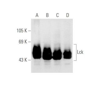 Lck Antibody (D-8) - Western Blotting - Image 67797 