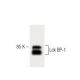 Lck BP-1 Antibody (9) - Western Blotting - Image 60349 