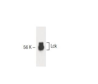 Lck Antibody (28) - Western Blotting - Image 60348