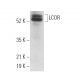 LCOR Antibody (G-4) - Western Blotting - Image 373166 