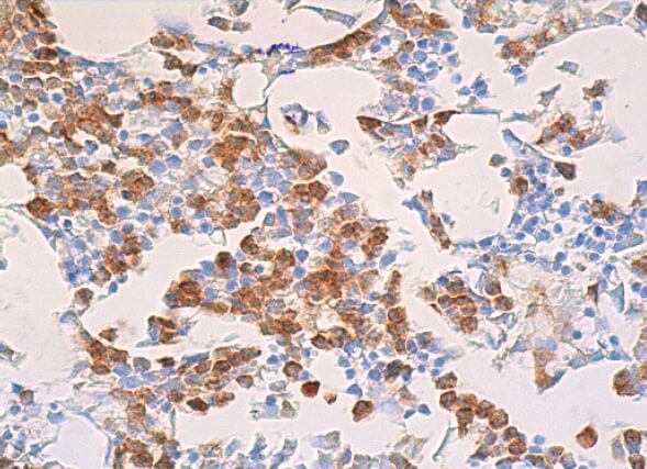 ldh-a-antibody-e-9-western-