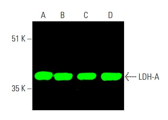 いラインアップ ldh-a-antibody-e-9-western- Nail Chip / Attached Nails