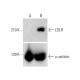 LDLR Antibody (F-7) - Western Blotting - Image 321861 