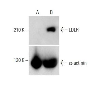 LDLR CRISPR Activation Plasmid (h): sc-400645-ACT. Western blot analysis of... 