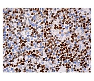 immunohistochemistry image from recommended LEF-1 (B-10) monoclonal antibody replacement. Image 159118