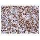 immunohistochemistry image from recommended LEF-1 (B-10) monoclonal antibody replacement. Image 159118