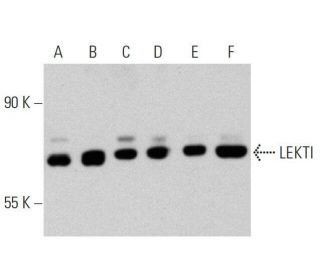 LEKTI Antibody (E-9) - Western Blotting - Image 359517 