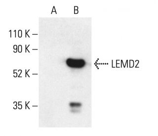 LEMD2 Antibody (H-12) - Western Blotting - Image 404067 