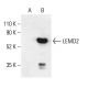 LEMD2 Antibody (H-12) - Western Blotting - Image 404067 