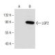 LGP2 Antibody (E-1) - Western Blotting - Image 150581